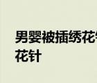 男嬰被插繡花針 具體情況是什么為什么插繡花針