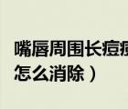 嘴唇周圍長痘痘怎么辦（嘴唇周圍經(jīng)常長痘痘怎么消除）