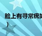 臉上有尋常疣如何根除（面部尋常疣能自愈嗎）