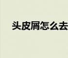 頭皮屑怎么去除男士（頭皮屑怎么去除）
