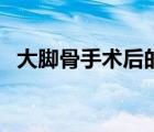 大腳骨手術(shù)后的后遺癥（大腳骨手術(shù)價格）