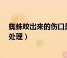 蜘蛛咬出來的傷口是怎樣的?（被普通蜘蛛咬了的傷口怎么處理）