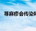 蕁麻疹會傳染嗎怎么治（蕁麻疹會傳染么）