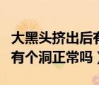 大黑頭擠出后有個洞怎么處理（大黑頭擠出后有個洞正常嗎）