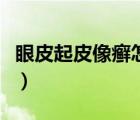 眼皮起皮像癬怎么辦（眼皮起皮像癬怎么回事）