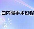 白內(nèi)障手術(shù)過程需要多久（白內(nèi)障手術(shù)過程）