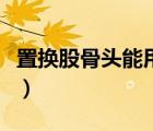 置換股骨頭能用幾年（置換股骨頭能用多少年）
