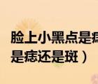 臉上小黑點(diǎn)是痣還是斑怎么去除（臉上小黑點(diǎn)是痣還是斑）