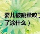 嬰兒被跳蚤咬了怎么止癢消腫（嬰兒被跳蚤咬了涂什么）