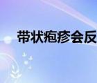 帶狀皰疹會(huì)反復(fù)嗎（帶狀皰疹會(huì)死人嗎）