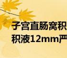 子宮直腸窩積液21mm嚴(yán)重嗎（子宮直腸窩積液12mm嚴(yán)重嗎）