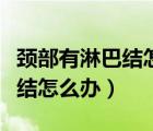 頸部有淋巴結(jié)怎么辦多久會消失（頸部有淋巴結(jié)怎么辦）