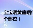 寶寶曬黃疸曬什么部位（寶寶曬黃疸主要曬哪個部位）