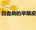白血病的早期皮疹（白血病的早期皮膚癥狀）