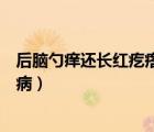 后腦勺癢還長紅疙瘩是什么?。ê竽X勺癢還長紅疙瘩是什么?。?/>
                                    </a>
                                                </div>
                                    <div   id=