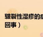 皸裂性濕疹的癥狀有哪些（皸裂性濕疹是怎么回事）