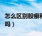 怎么區(qū)別股癬和艾滋?。ü砂_是艾滋病的初期嗎）