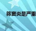 篩竇炎是嚴(yán)重的病嗎（篩竇炎是什么?。?/>
                                    </a>
                                                </div>
                                    <div   id=
