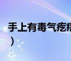 手上有毒氣疙瘩圖片（手上有毒氣疙瘩怎么辦）