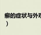癬的癥狀與外觀怎么治療好（癬的癥狀有哪些）