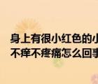 身上有很小紅色的小血點(diǎn)不癢不疼痛（身上有紅色的小血點(diǎn)不癢不疼痛怎么回事）