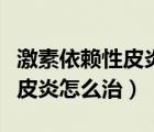 激素依賴性皮炎怎么治療能徹底（激素依賴性皮炎怎么治）