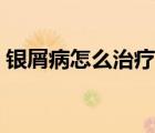 銀屑病怎么治療為好（銀屑病怎么治療最好）