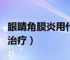 眼睛角膜炎用什么方法治療（眼睛角膜炎怎么治療）