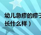 幼兒急疹的疹子是什么樣（幼兒急疹出的疹子長什么樣）