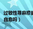 過敏性蕁麻疹能自己自愈嗎（過敏性蕁麻疹能自愈嗎）