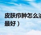 皮膚癤腫怎么治療最快最好（長癤用什么藥膏最好）