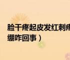 臉干疼起皮發(fā)紅刺疼緊繃用什么藥（臉干疼起皮發(fā)紅刺疼緊繃咋回事）