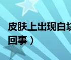 皮膚上出現白塊怎么辦（皮膚上出現白塊怎么回事）