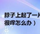 脖子上起了一片紅疹子擦什么藥（脖子起紅疹很癢怎么辦）