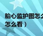 胎心監(jiān)護(hù)圖怎么看有無規(guī)律宮縮（胎心監(jiān)護(hù)圖怎么看）