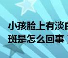 小孩臉上有淡白斑怎么治療（小孩臉上有淡白斑是怎么回事）