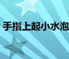手指上起小水泡很癢（手指上起小水泡很癢）