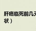 肝癌臨死前幾天的癥狀（肝癌臨死前幾天的癥狀）