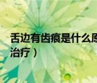 舌邊有齒痕是什么原因吃什么藥（舌邊有齒痕是什么原因及治療）