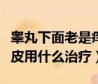 睪丸下面老是癢抓破皮（睪丸下面很癢抓了脫皮用什么治療）