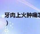 牙肉上火腫痛怎么辦（牙肉上火腫痛怎么消腫）