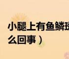 小腿上有魚鱗斑怎么回事（小腿上有魚鱗斑怎么回事）