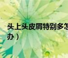 頭上頭皮屑特別多怎么辦用什么藥（頭上頭皮屑特別多怎么辦）