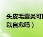 頭皮毛囊炎可以自愈嗎?（頭皮毛囊炎大包可以自愈嗎）