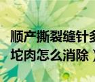 順產(chǎn)撕裂縫針多出一塊肉（順產(chǎn)撕裂縫針后有坨肉怎么消除）