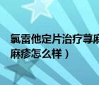 氯雷他定片治療蕁麻疹效果怎么樣（開瑞坦氯雷他定片對蕁麻疹怎么樣）