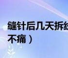 縫針后幾天拆線怎么計(jì)算（縫針后幾天拆線痛不痛）