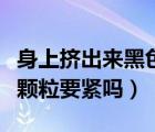 身上擠出來黑色顆粒要緊嗎（身上擠出來黑色顆粒要緊嗎）