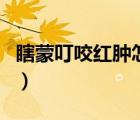 瞎蒙叮咬紅腫怎么消腫（瞎眼蒙咬了怎么消腫）