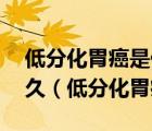 低分化胃癌是什么意思,得了這個(gè)癌最長(zhǎng)活多久（低分化胃癌）
